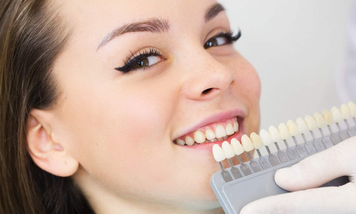 Украсьте свою улыбку с помощью отбеливания зубов: раскрываем секреты ослепительной улыбки