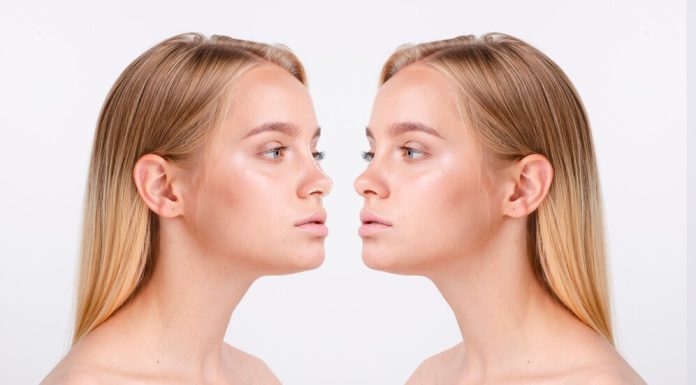 Синус лифтинг: Современные технологии возрождения молодости