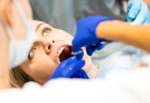 Удаление корня зуба: когда необходимо и как проходит процедура