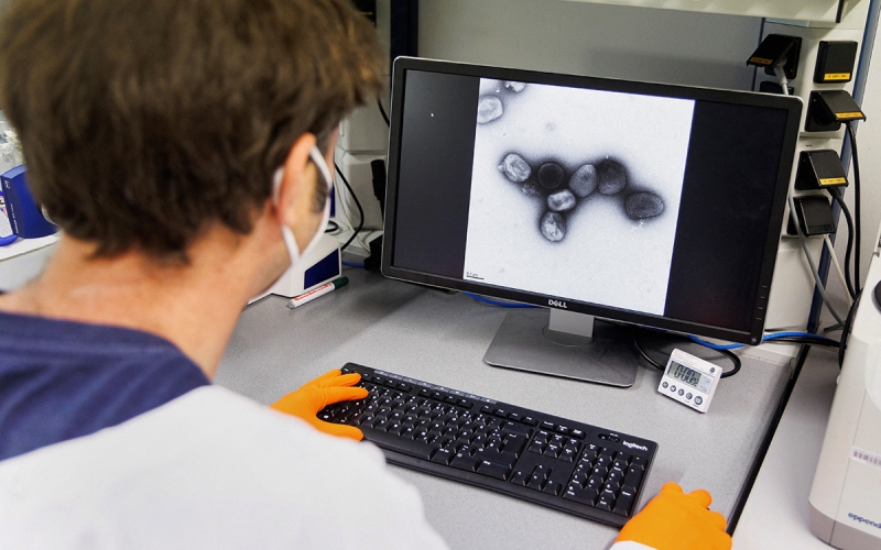 Билл Гейтс оценил опасность оспы обезьян и назвал сроки новой пандемии