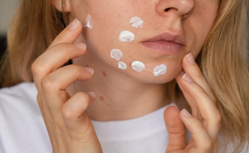 Эксперты оценили опасность появления канцерогена в средствах от прыщей