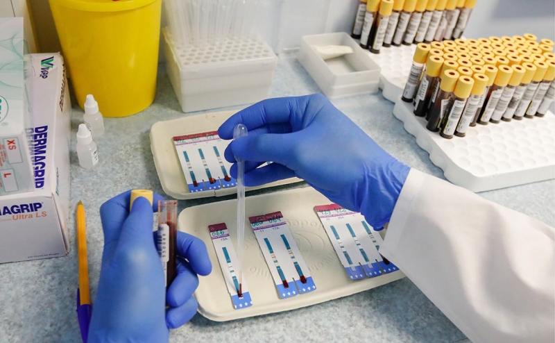 Эксперты оценили ситуацию с ВИЧ в российских регионах