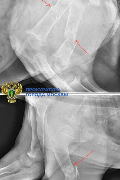 Львенка в тяжелом состоянии забрали у блогера в &laquo;Москва-Сити&raquo;