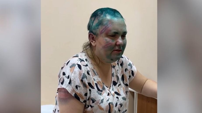 Милашина рассказала подробности о нападении в Чечне