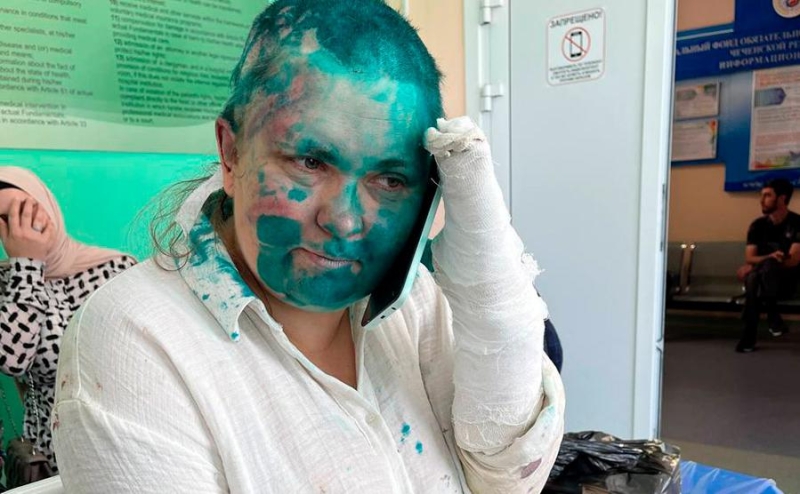 Москалькова обратилась в СК и прокуратуру Чечни из-за избиения