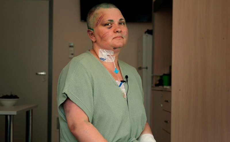 Облитая зеленкой адвокат Пономарева получила ожог глаз