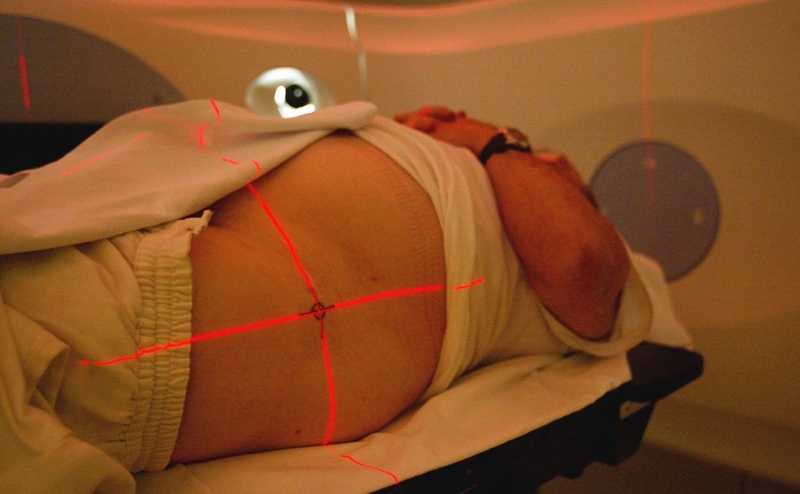 Онкологи оценили идею перестать называть раком некоторые его виды