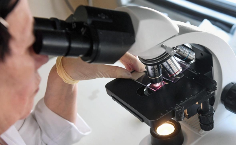 Роспотребнадзор назвал причину вспышки ботулизма в Москве