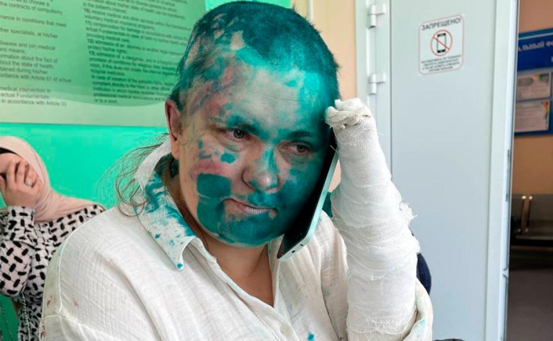 У Милашиной диагностировали черепно-мозговую травму, переломы и ушибы