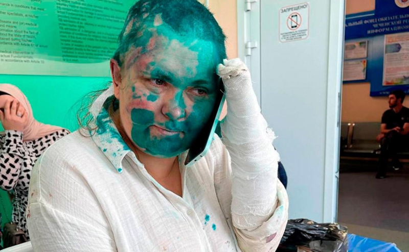 У Милашиной диагностировали черепно-мозговую травму, переломы и ушибы