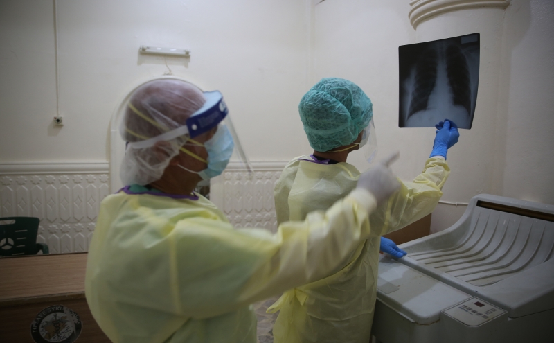 Ученые узнали о способности COVID-19 месяцами распространяться в органах