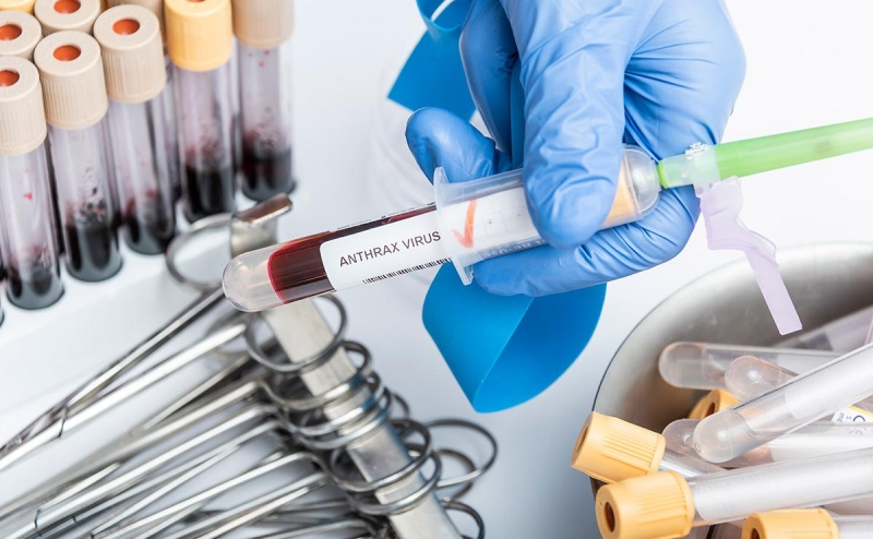 В Воронежской области выявили новые случаи заражения сибирской язвой