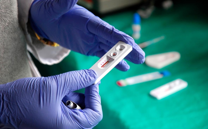 В ВОЗ заявили о самой стремительной эпидемии ВИЧ в Европе