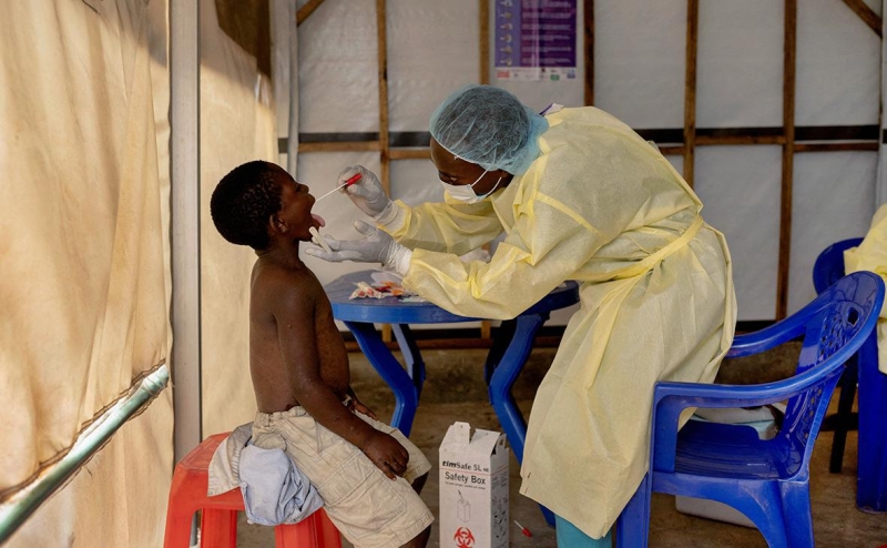 Вирусологи оценили риск эпидемии оспы обезьян в России