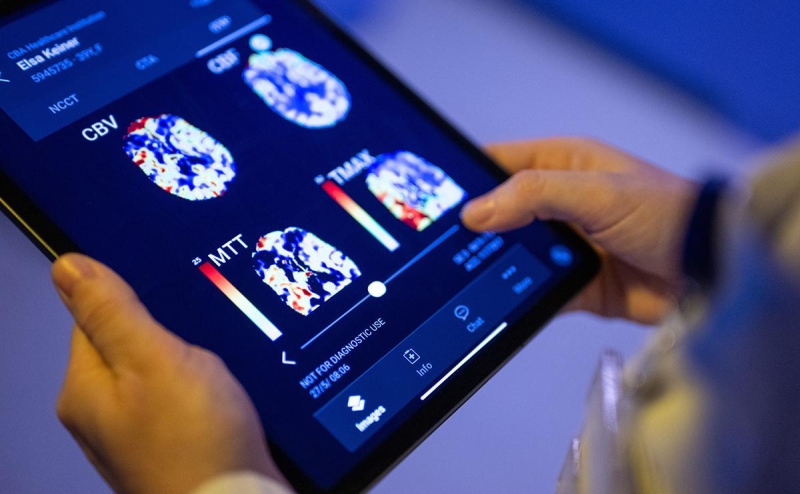 Живым в помощь: как внедряются нейросети в российской медицине